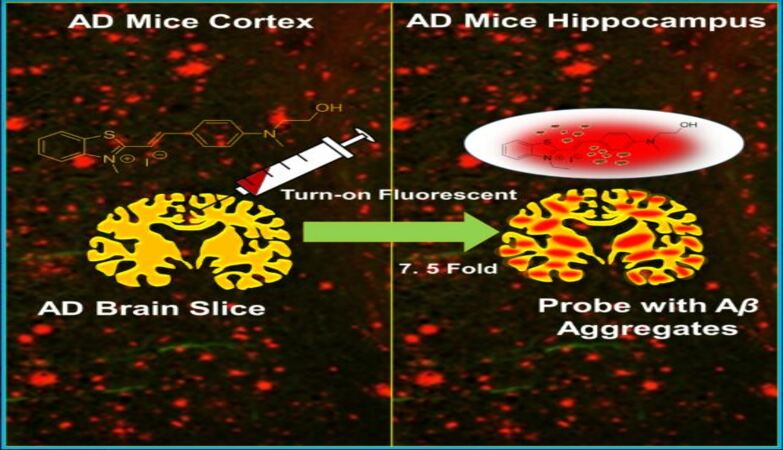 IIT Jodhpur led multi-institutional team finds effective fluorescent probe for the diagnosis of Alzheimer’s disease